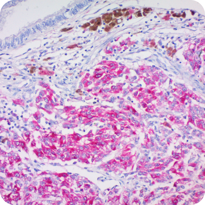 Tyrosinase; Clone T311 (Concentrate)